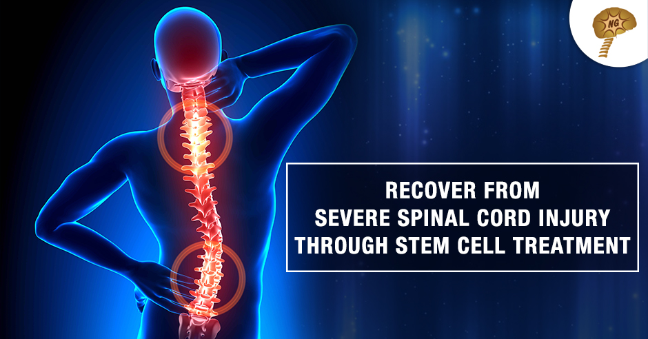 Recover From Severe Spinal Cord Injury by Stem Cell Treatment at NeuroGen