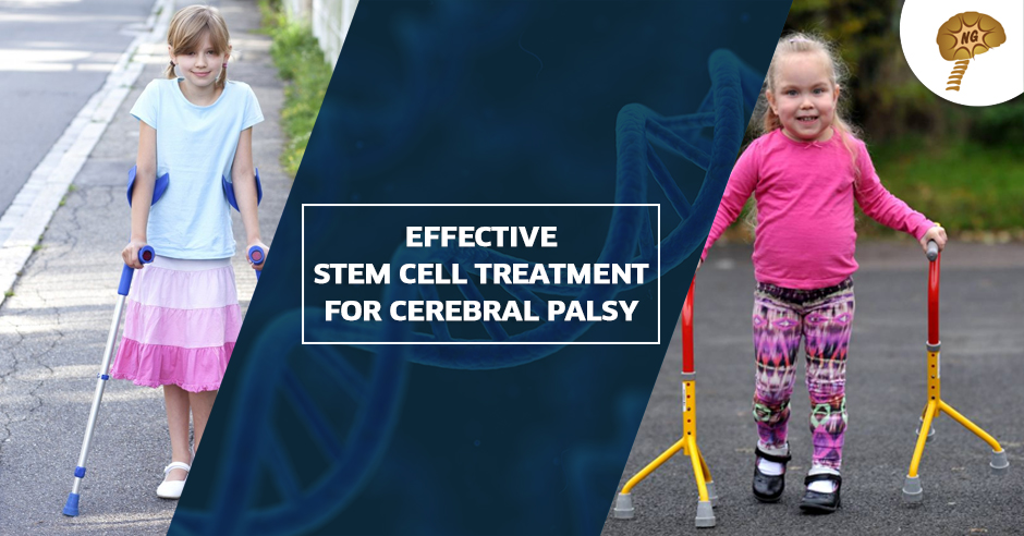 Effectiveness Of Stem Cell Therapy In Cerebral Palsy Treatment - NeuroGen