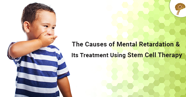 causes-of-intellectual-disability-and-its-treatment-using-stem-cell