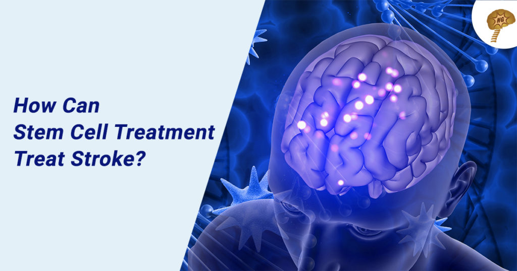 Treat Stroke With Stem Cell Stroke Treatment Neurogen Bsi