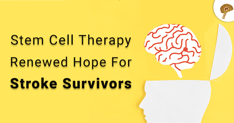 Stem Cell Therapy: Renewed Hope For Stroke Survivors - NeuroGenBSI