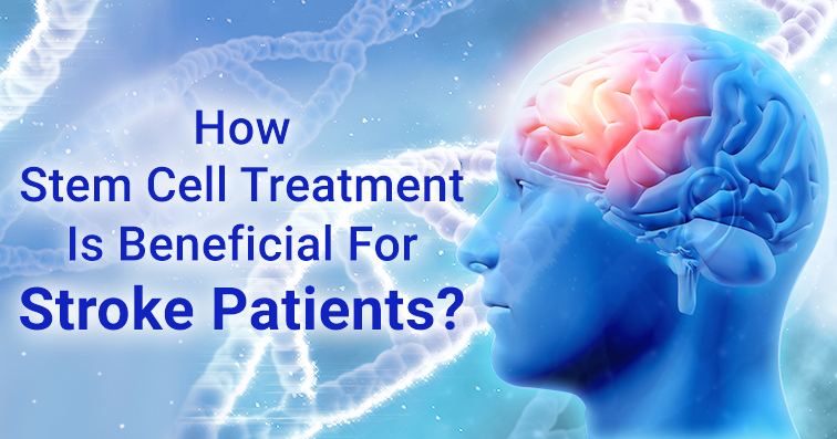 How Stem Cell Treatment Is Beneficial For Stroke Patients - NeuroGenBSI