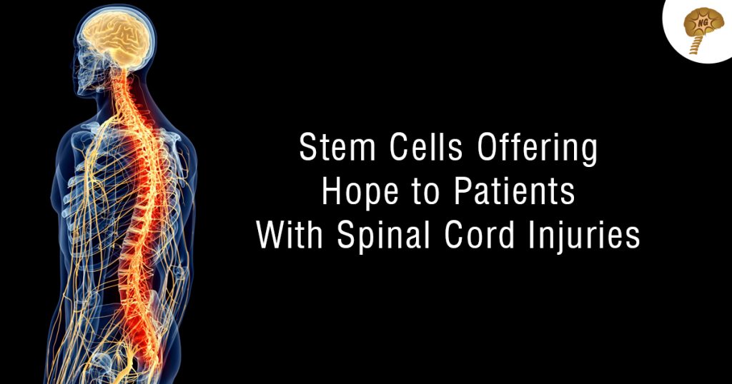 Stem Cells Offering Hope to Patients With Spinal Cord Injuries