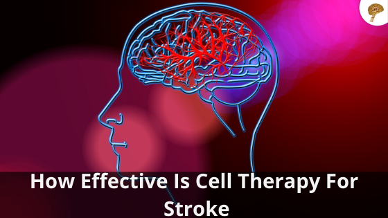 anti stroke treatment